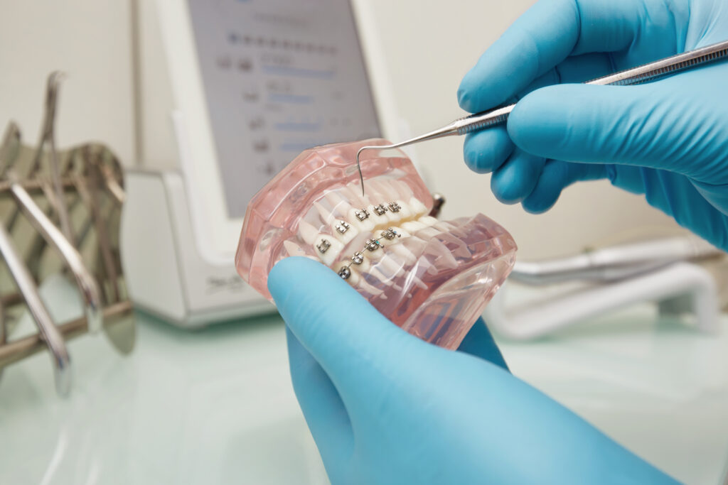 dentysta trzymający model plastyczny zęba z aparatem ortodontycznym